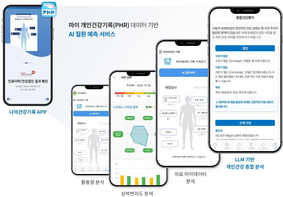 스트레스 측정 기기
